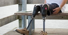 Инновационные протезы ног